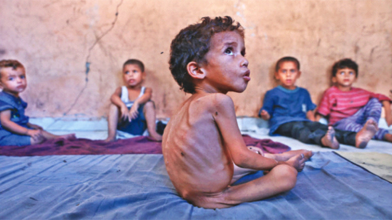 গাজায় ক্ষুধা-অপুষ্টিতে দুই বছরে ৪৩২ জনের মৃত্যু...